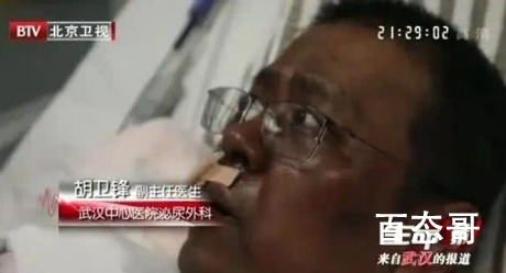 武汉中心医院医生胡卫锋离世 到底是怎么回事