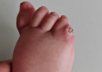 医生给幼儿小脚趾手术失误致截肢 该名医生是否有医师资格证？