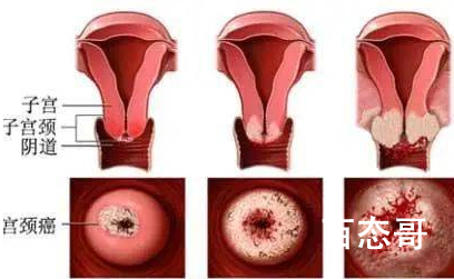 专家建议女性每年要做妇科检查 女生要防范于未然！