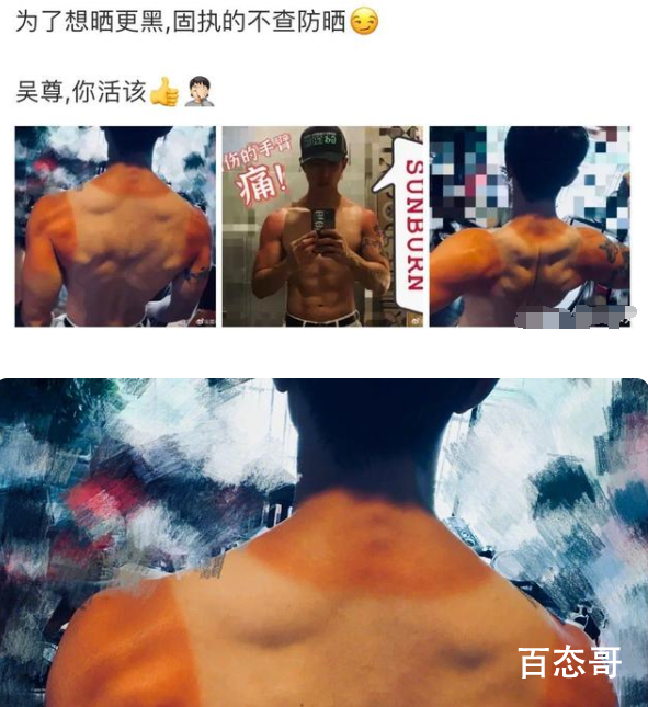 吴尊晒伤后像穿了件背心 吴尊为什么会晒伤到底是怎么回事？