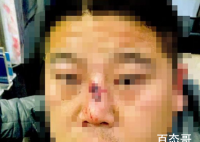 2人争挖掘机技术谁更强1人被打骨折 话说挖掘机技术哪家强看了打人也强