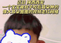 萌娃耳朵被蚊子叮成大耳朵图图 画面太美不敢看