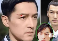 胡歌出意外前后照片对比  胡歌出意外是什么时候