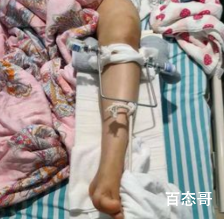 女子首次上瑜伽课 被老师压断大腿老师要付全责