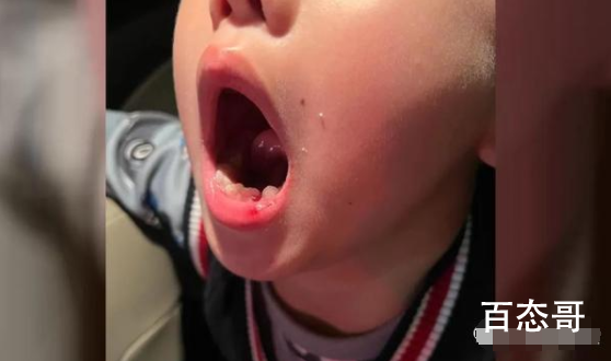 6岁男童被钢琴老师扇掉一颗牙 就这样还配做老师！