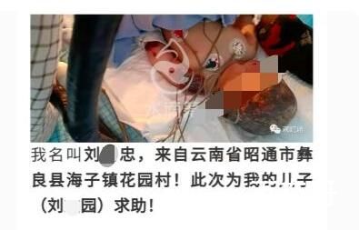 云南1岁男婴烧伤父亲卷善款失联 背后的真相让人震惊！