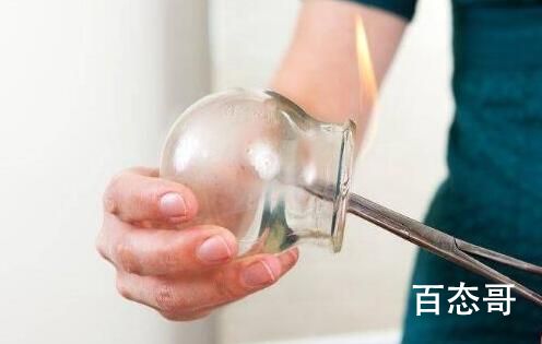拔罐后留下的印子是不是越大越好