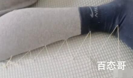 男子躺5小时不起被妻子缝在沙发上 这个针法有点东西的