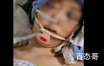 女子被无业丈夫打进ICU后离世 背后的真相让人震惊