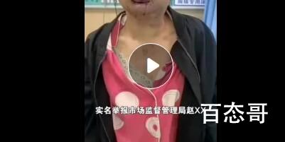 女子实名举报公职丈夫出轨家暴 这男的下手也太狠了吧