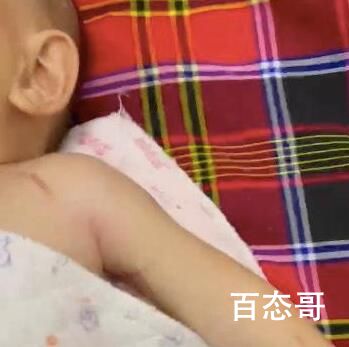 新生儿臂丛神经被医生拉断 院方回应医院愿不愿意负责终身免费为其治疗康复？