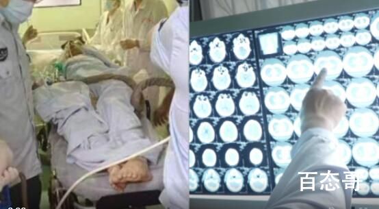 高考生查分第2天突发脑出血住进ICU 就这承受能力？
