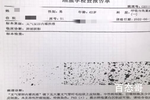 男子患罕见病肺部洗出17升“牛奶” 究竟是怎么一回事？