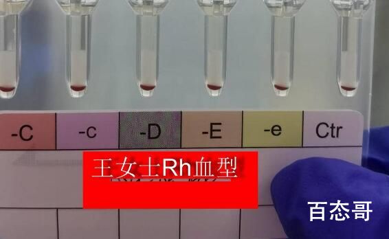 江苏发现2例全球罕见黄金血型 可以给血库存一些血液等到后期需要可以直接用