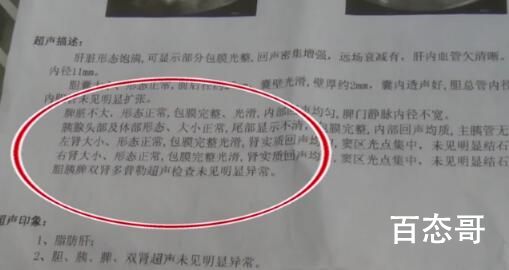 手术摘除1个肾十年后查出2个肾 背后的真相让人惊愕！