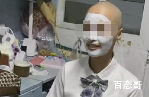 女学生频繁掉发索性剃成光头 这真是的是一劳永逸
