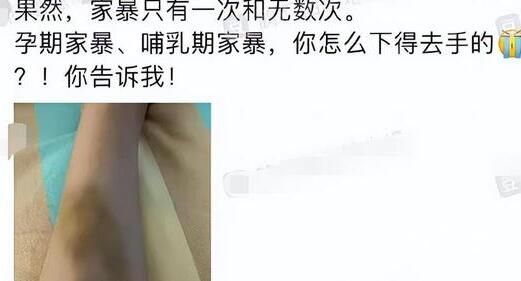 《甄嬛传》槿汐扮演者孙茜疑被家暴 当初爱的那么真切？