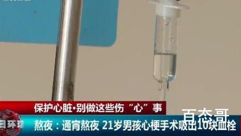 21岁男子长期熬夜吸出10块血栓 背后的真相让人惊愕