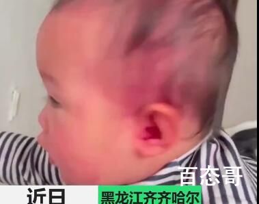1岁娃玩药粉妈妈帮清洗全被染紫 到底是什么情况