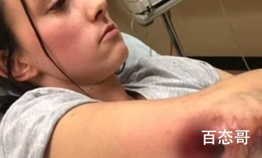 瑞士工人跌入720℃熔炉爬出生还 背后的真相让人始料未及