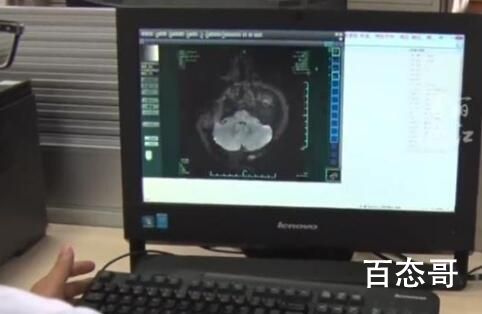 女子饭店吃饭被陌生医生提醒患病 背后的真相让人始料未及
