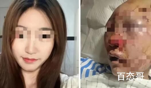 女子公厕被打 嫌犯将做精神鉴定 精神不正常为什么不打自己家里人？