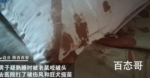 男子熟睡时疑被老鼠咬破头 灭鼠一事终于可以提上日程了