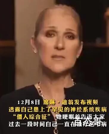 席琳迪翁患僵人综合征 衷心的祝愿你早日康复