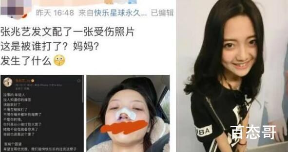 张兆艺个人资料简介  张兆艺玻璃门事件来龙去脉  张兆艺什么时候结婚的