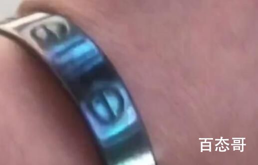 女子退烧后发现银手镯变黑了 背后的真相让人震惊