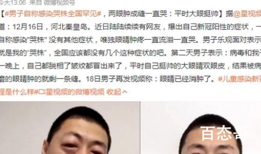 男子自称感染“哭株”全国罕见 他这是鼻子过敏导致不停流泪