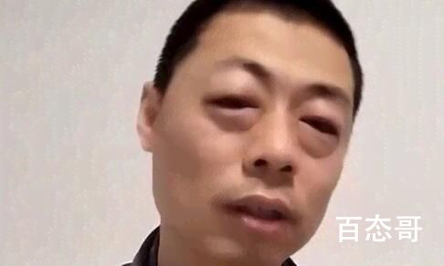 花样毒株是什么意思