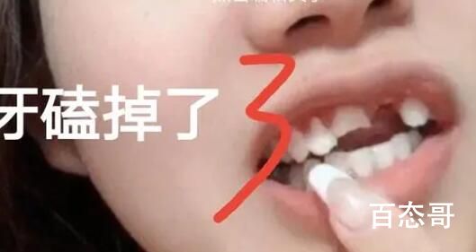 女子阳后一周锻炼晕倒摔断3颗牙 阳康后不好好休息就惩罚你