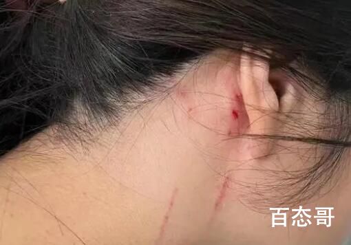 回家过年拒绝相亲 河南母女被打入院 背后的真相让人始料未及