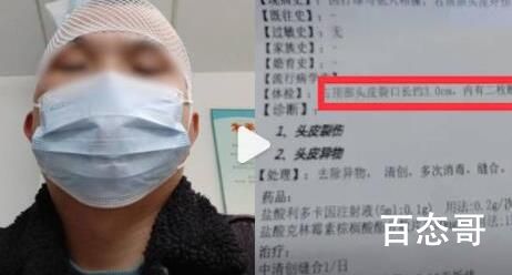男子打球6天后头皮里发现2颗牙 背后的真相让人震惊