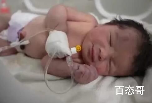 获救女婴脐带仍与遇难母亲相连 只能说这孩子命真硬