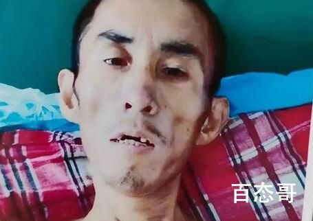 广东高院回应智障男子被当劫犯关9年 内幕曝光出狱后两个月因病重不治去世