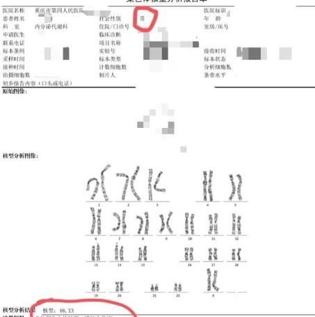 重庆一男子求子不得查出女儿身 就是先天性不孕不育症的男性没错吧？