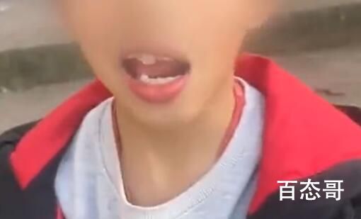 男孩长蛀牙爸爸用电钻钻牙止痛 背后的真相让人始料未及