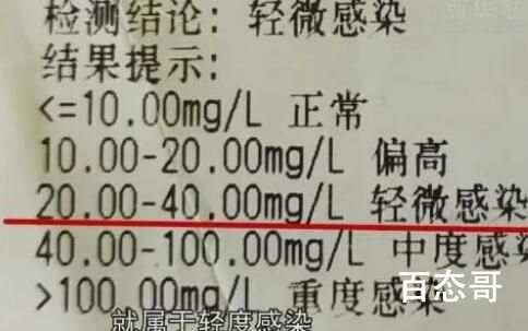 宠物医院收费乱象调查 宠物看病比人都贵