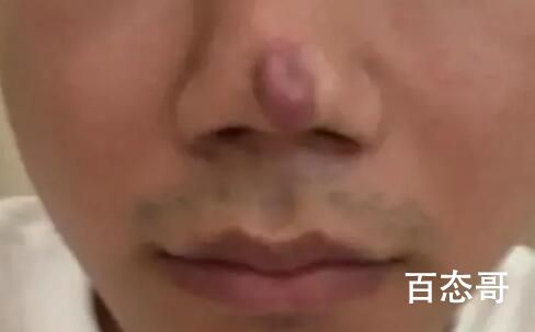 男子整形后称没法靠颜值吃饭了 可以改用嘴吃饭啊