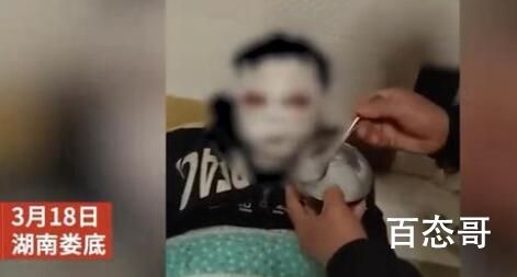 12岁男孩看短视频学做火药被炸伤 出师未捷这是未来的发明家