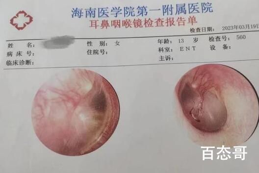 13岁女孩遭霸凌鼓膜穿孔 警方介入对被害女生要进行心理疏导和人文关怀