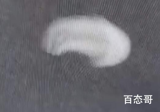 女子摔跤上牙磕进嘴唇1月后才发现 内幕曝光引争议