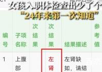 24岁女孩入职体检查出少一个肾 孤立肾往往合并生殖系统异常