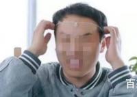 徐志胜头太大把项链卡住了 戴项链结果戴成了头链