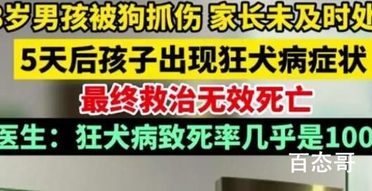 男孩被狗抓伤患狂犬病20天后死亡 城市内养狗真得好好管管了！