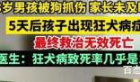 男孩被狗抓伤患狂犬病20天后死亡 城市内养狗真得好好管管了！