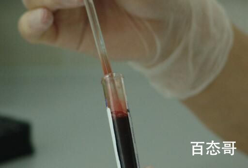 癌症在我国已经熬成慢性病 为什么生病的人越来越多食品添加剂太多了！