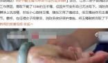 女子戴玉镯10年关节变形成手铐 这意味着什么